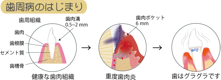 ロゴを挿入